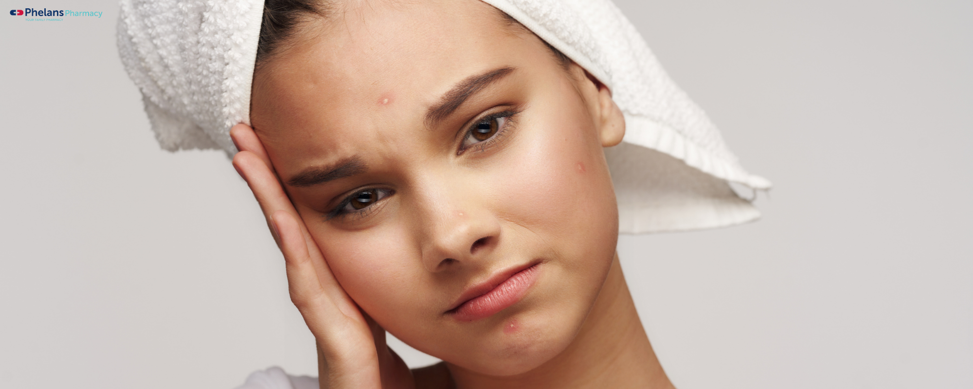 Top Tips For Acne Prone Skin