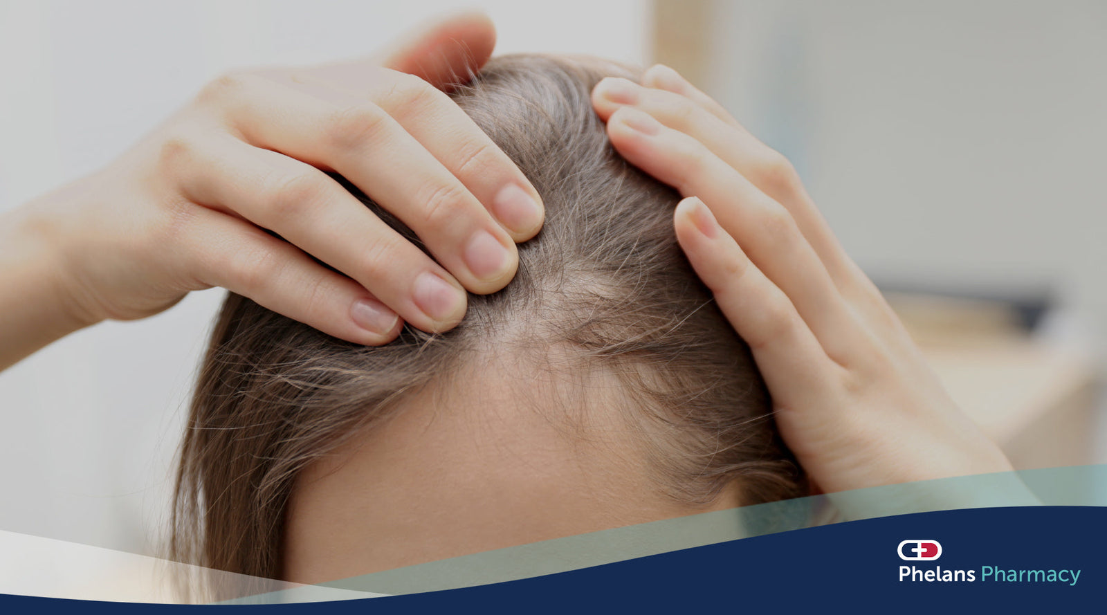 Understanding Hair Loss: What You Need to Know