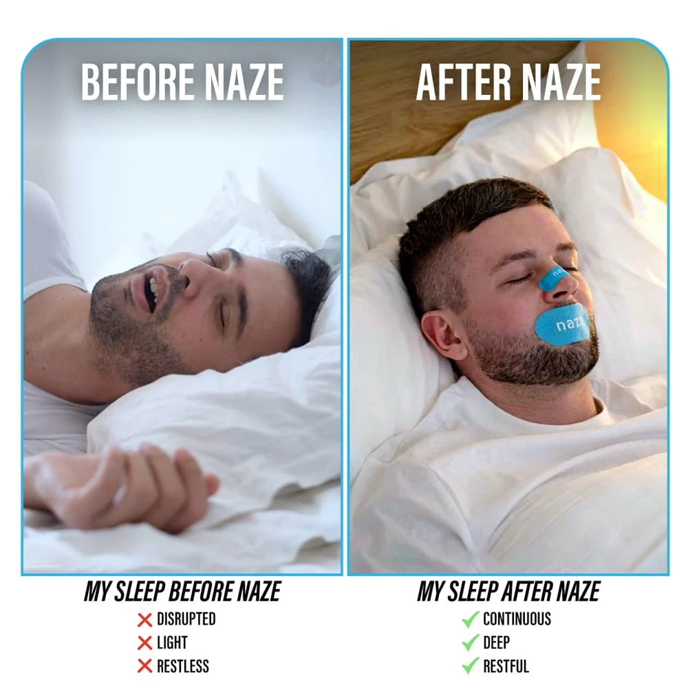 Naze Strip Combo Nose and Mouth Tape (30 Pieces)