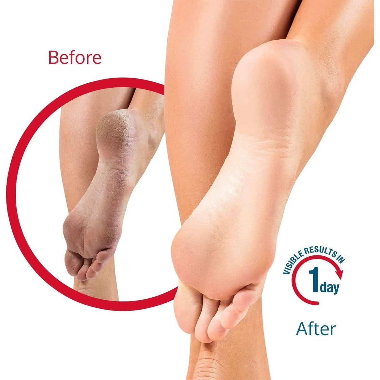 Flexitol Rescue Heel Balm 112g