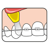 TePe Interspace Brush Soft